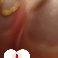 画像612